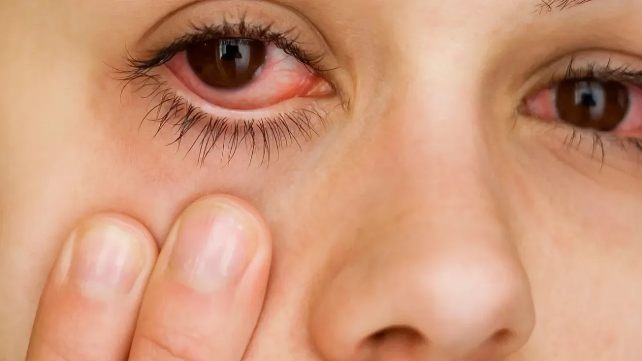 Kışın gözlerinizi tehdit eden sessiz düşmanlar: Dikkat!