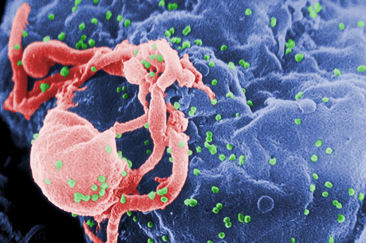 HIV: Tanım, bulaşma yolları ve güncel tedavi yöntemleri