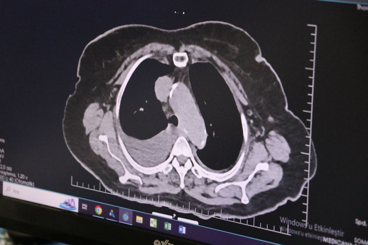 Gençlerin kalbi tehlikede: Uzmanlardan hayati uyarı