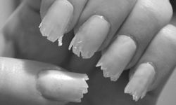 Rüyada tırnak kırılması ne anlama geliyor?