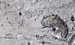 Yüzünüzde gizlenen minik misafirler: Demodex akarları hakkında bilmeniz gerekenler