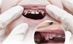 Çocukların diş sağlığı sizin elinizde!