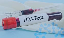 Kimse kim olduğunuzu sormuyor! Ücretsiz ve güvenli HIV testi başladı!