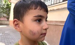 Lağım faresi alarmı: Evde uyurken ısırdı!