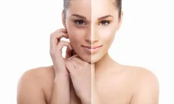 Açık ten algısı kadınları hasta ediyor: Uzmanlar uyardı!