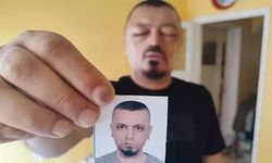Berberin tavsiyesi hayatını kabusa çevirdi: ‘Gözlerimi kaybedeceğim diye çok korktum’