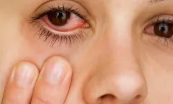 Kışın gözlerinizi tehdit eden sessiz düşmanlar: Dikkat!