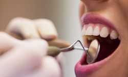 Ağız sağlığında yeni çığır: Diş minesi artık kendini onarabilecek!