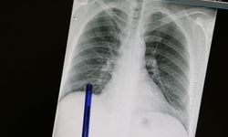 Basit semptomlar kanser habercisi olabilir