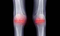 Hareketsizlik sessizce ekleminizi yok ediyor!