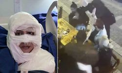 Dehşete düşüren olay! Bir kadın başka bir kadını yaktı!