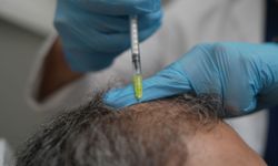 Dökülen saçlar, vücudun verdiği kritik bir uyarı olabilir!