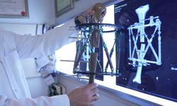 Boyu kısa olanlar dikkat! Yeni yöntemle santimler mümkün