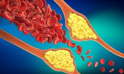 Kalp sağlığı için lif mucizesi: Kolesterolü düşüren besinler