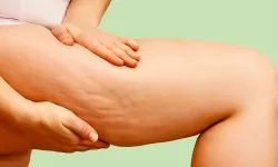 Diyetle geçmiyor, her adımda ağrı yapıyor! Bu tedavi umut oluyor