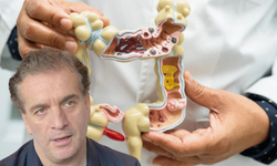 Murat Cemcir'i hastanelik eden rahatsızlık: Divertikül kanama nedir? Uzman uyardı!