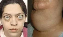 Normal yemeye devam ediyorsunuz ama kilo kaybediyorsunuz! İşte sebebi…