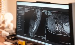 Annelerin fark ettiği bu detay, çocukların hayatını kurtarıyor