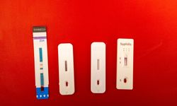 Ege Üniversitesi’nde yeni test polikliniği hizmete girdi