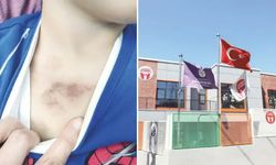 İBB kreşinde istismar ve darp iddiası: Sevk yazısı ortaya çıktı