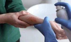 Kanamayı saniyeler içinde durduran sprey: Bilim insanlarından kritik buluş