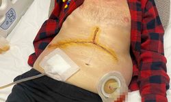 Baba, kızının karaciğeriyle yeniden hayata döndü!