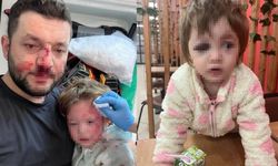 Yalova'da komşu kavgası: 14 aylık bebeğin kafatası çatladı