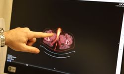 Dünyada 60 kişide görüldü, son vaka Diyarbakır’dan