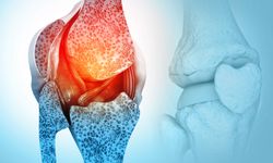 Kemik erimesi erken dönemde tespit edilebilir!