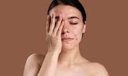 Cilt bakımında sosyal medya tuzağı: Uzmanlar 'Uzak durun' dedi