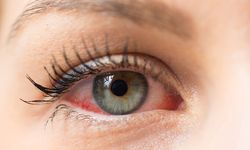 Her gün yapıyoruz ama meğer gözleri bitiriyormuş!