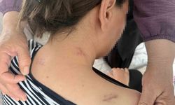 Ölü numarası yaparak kurtuldu! 17 bıçak darbesi alan kadın yaşadığı kabusu anlattı