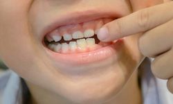 Rüyada diş dökülmesi ne anlama gelir?