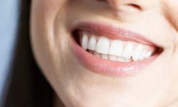 Rüyada diş görmek ne anlama gelir?