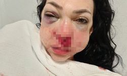 Anne ve oğlunun darbedildiği kafe saldırısı davasında ilk duruşma