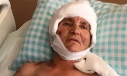 Köpekler saldırdı, dudak uçuklatan tazminat çıktı!