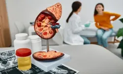 Böbrek kanseri sessiz ilerliyor: 3 belirtiye dikkat!