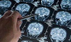 Derin uyku Alzheimer’ın ilerleyişini yavaşlatabilir!
