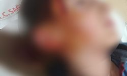 Menderes’te köpek saldırısına 1,2 milyon TL tazminat