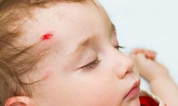 Ciddi kafa travmaları epilepsiye neden olabilir