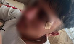 Öğrenci yaralandı, öğretmen hakkında soruşturma