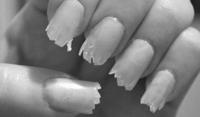 Rüyada tırnak kırılması ne anlama geliyor?