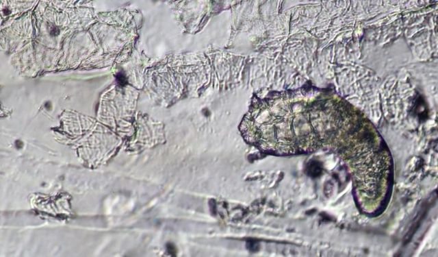 Yüzünüzde gizlenen minik misafirler: Demodex akarları hakkında bilmeniz gerekenler