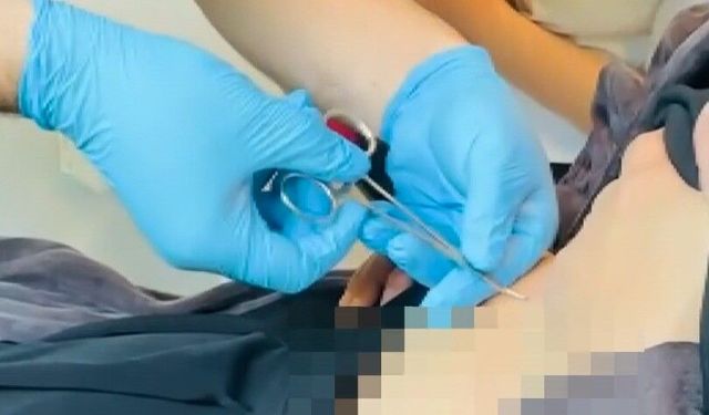 Karın ağrısıyla gitti, göbeğinde kene çıktı!