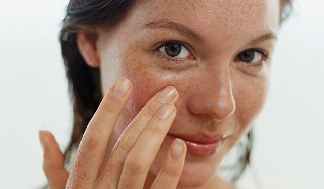 Dermatologlardan ‘Leke’ alarmı: Yaz gelmeden bu önlemleri alın!