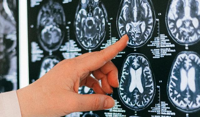 Dört basit alışkanlık beyni 8 yıl gençleştiriyor