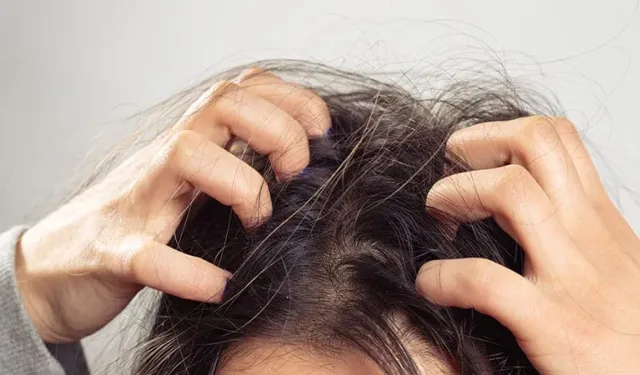 Masum sanmayın: Saç deriniz neden kaşınıyor? İşte yanıtı
