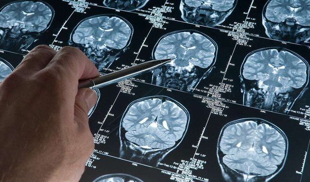 Derin uyku Alzheimer’ın ilerleyişini yavaşlatabilir!