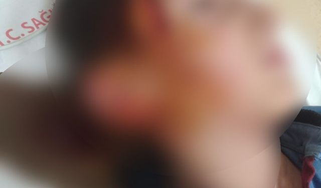 Menderes’te köpek saldırısına 1,2 milyon TL tazminat