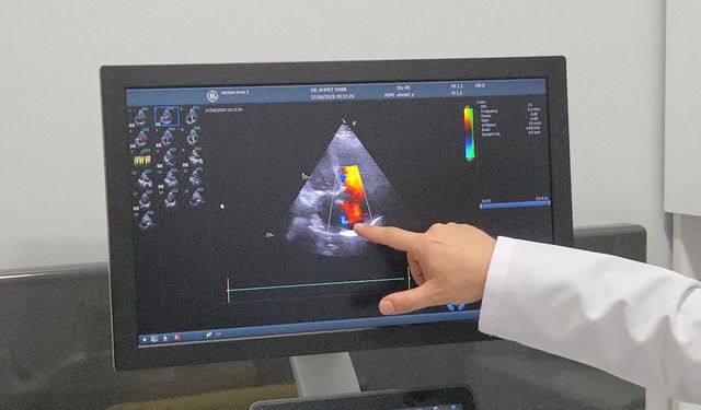 Kalp kapağı kaçağında ameliyatsız tedavi: Triklip